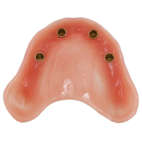 Vista 4 de Modelo de sobredentadura dental con 4 implantes para enseñar a estudiar el modo de demostración de la práctica dental (CLEAR)