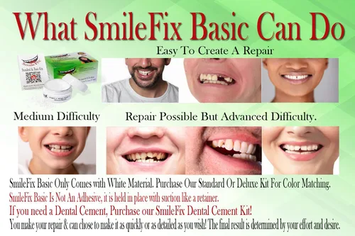Vista 2 de SmileFix - Reparación dental básica para dientes perdidos o dañados, arregla huecos, dientes perdidos, espacios, dientes rotos, rápido y fácil