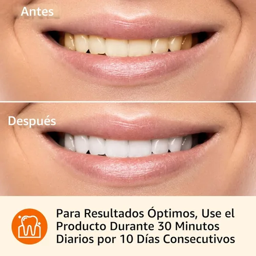 Vista 5 de Amazon Basics Kit de tiras blanqueadoras de dientes de 10 días, 10 tratamientos, 1 paquete (anteriormente Solimo)
