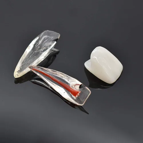 Vista 7 de Modelo patológico de restauración de pulpa dental de diente frontal, modelo endodóntico humano