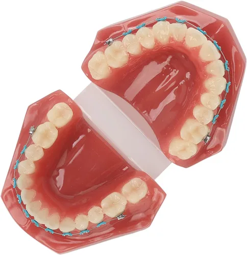 Vista 4 de Modelo de cuidado de dientes, 28 piezas de resina de dientes enseñanza con soportes de metal, modelo de dientes para estudiantes, modelo de dientes
